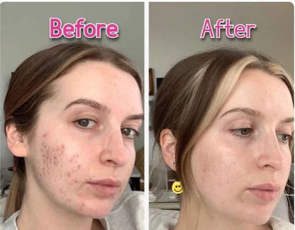 3 - in - 1 Facial & Neck Beauty Device – EMS Lifting, LED Therapy & Double Chin Treatment - Saadiq.pk