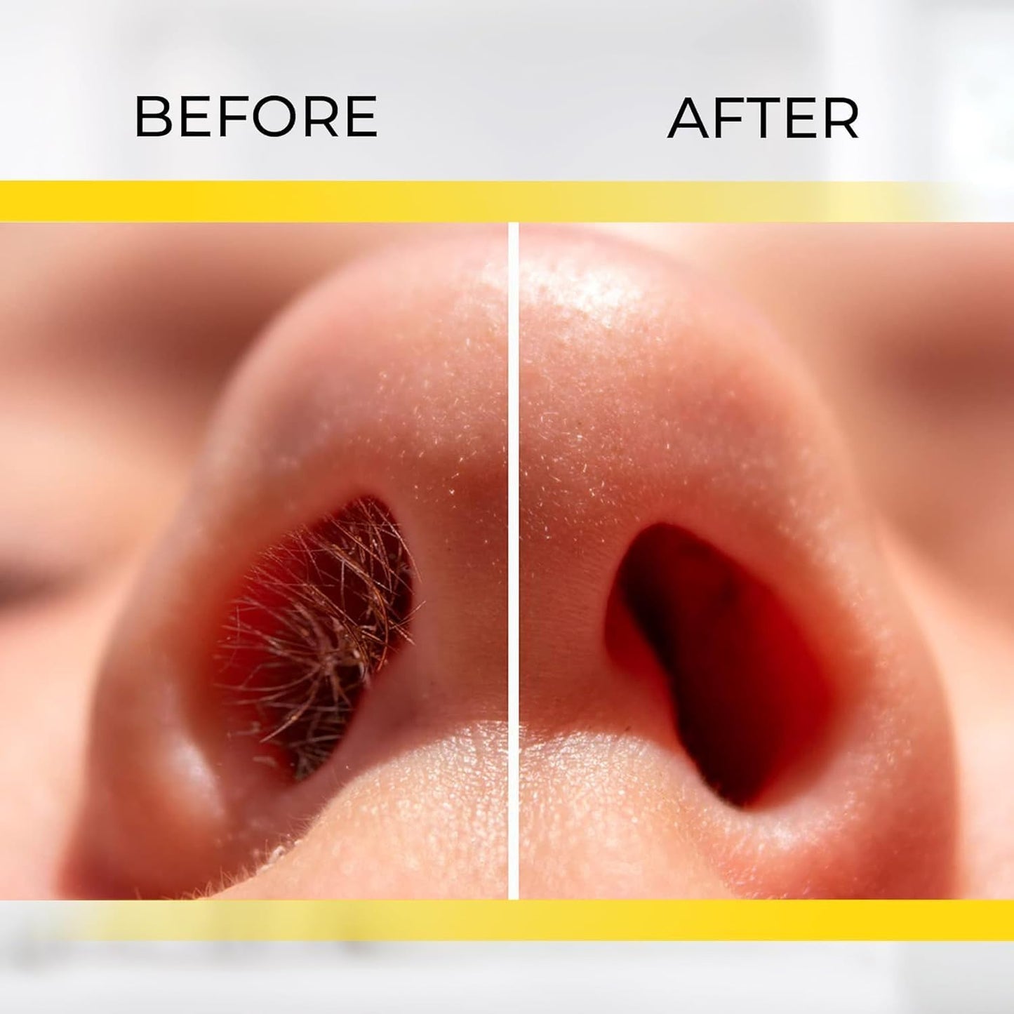 Stainless Steel Manual Nose Hair Trimmer | Safe & Painless Nose Hair Cutter | Manual Rotary Grooming Tool for Men