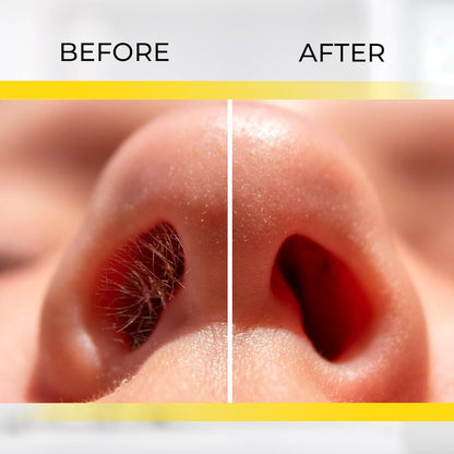 Stainless Steel Manual Nose Hair Trimmer | Safe & Painless Nose Hair Cutter | Manual Rotary Grooming Tool for Men