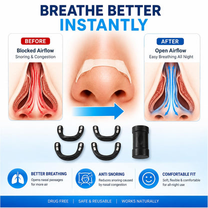 Magnetic Nasal Dilator Kit | Anti Snoring Device