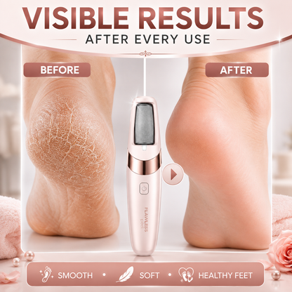 Rechargeable Electric Foot Callus Remover | Cordless Pedi Roller for Dry, Cracked Heels & Dead Skin