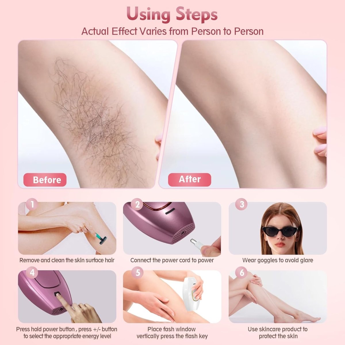 IPL Hair Removal Device for Home Use – Painless Full Body Hair Removal Machine - Saadiq.pk