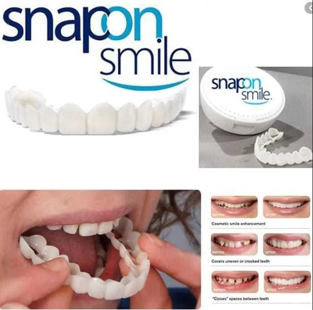 Snap - On Smile Moldable False Teeth Veneers with Artificial Braces Kit for Men & Women – Temporary Cosmetic Dental Solution - Saadiq.pk