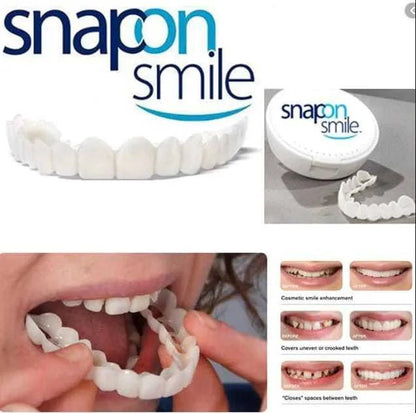 Snap - On Smile Moldable False Teeth Veneers with Artificial Braces Kit for Men & Women – Temporary Cosmetic Dental Solution - Saadiq.pk