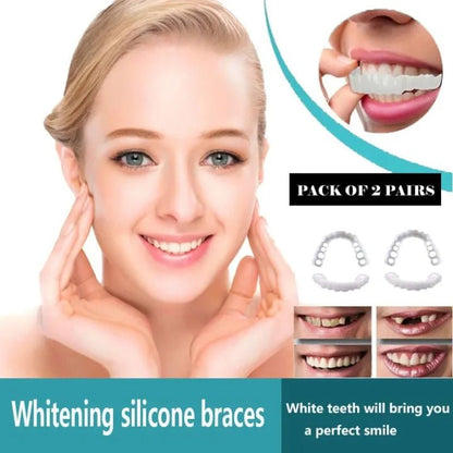 Snap - On Smile Moldable False Teeth Veneers with Artificial Braces Kit for Men & Women – Temporary Cosmetic Dental Solution - Saadiq.pk
