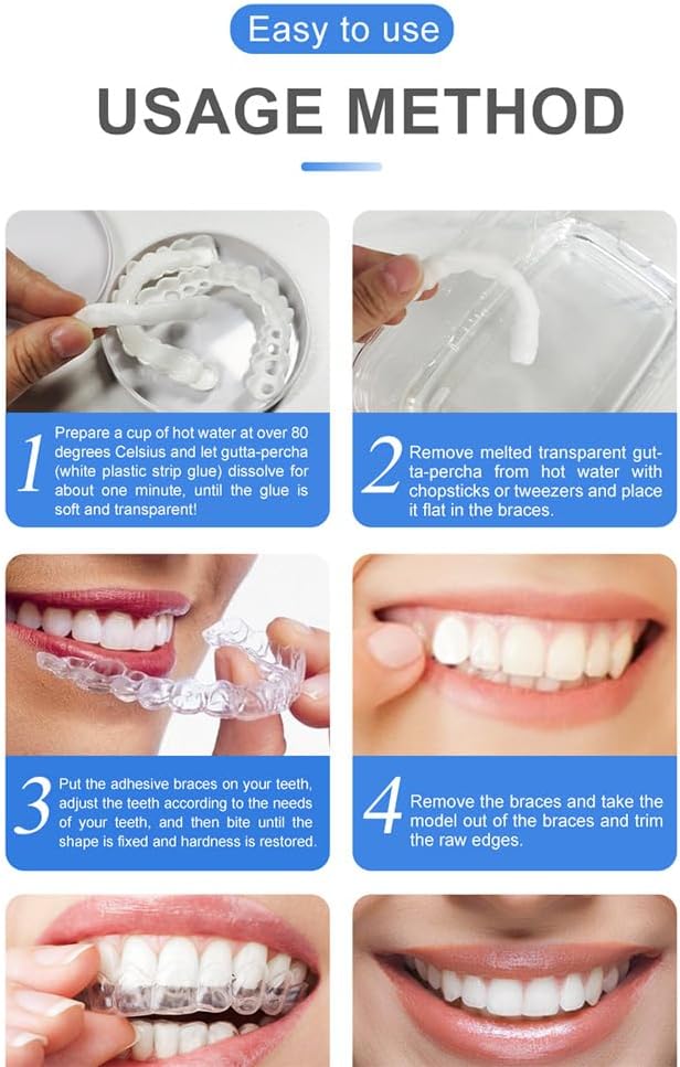 Snap - On Smile Moldable False Teeth Veneers with Artificial Braces Kit for Men & Women – Temporary Cosmetic Dental Solution - Saadiq.pk