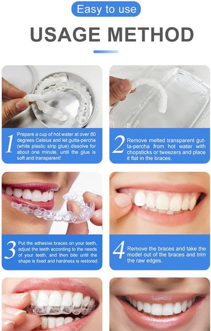 Snap - On Smile Moldable False Teeth Veneers with Artificial Braces Kit for Men & Women – Temporary Cosmetic Dental Solution - Saadiq.pk